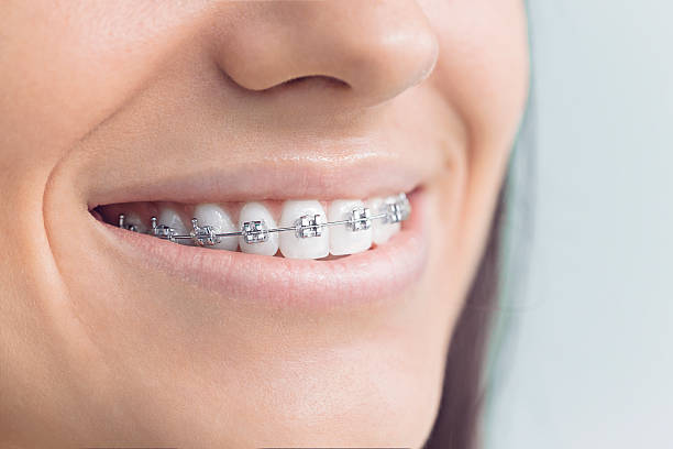 Best Invisalign and Clear Aligners  in Basking Ridge, NJ